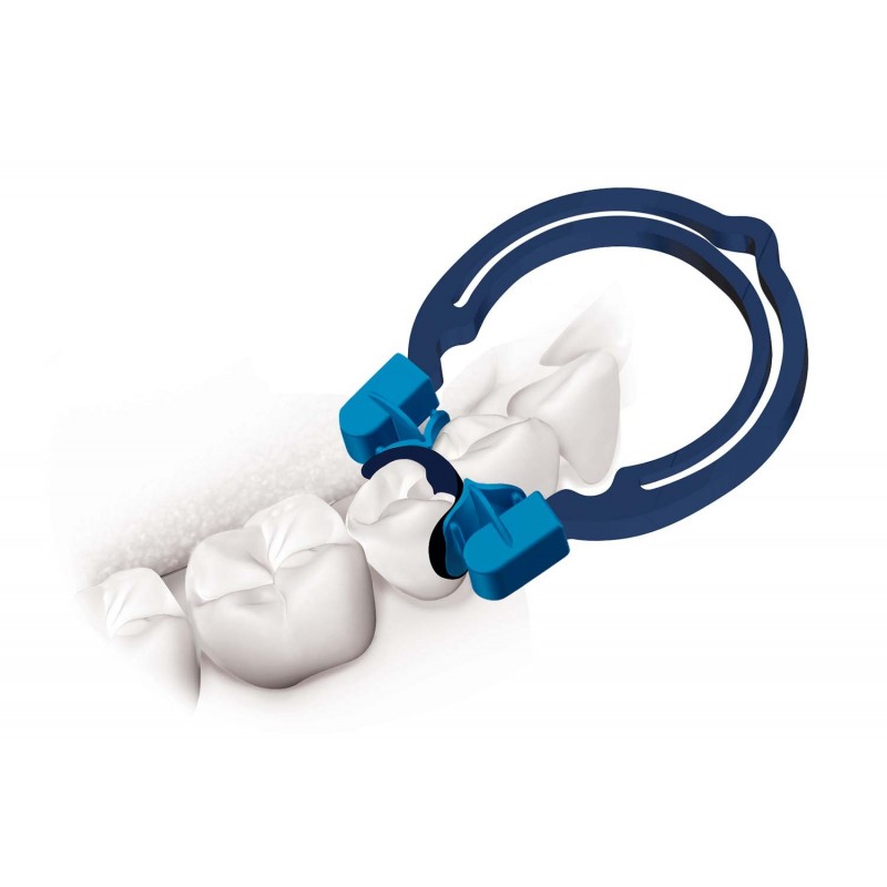 MyQuickmat Forte Kit 6803 комплект Polydentia