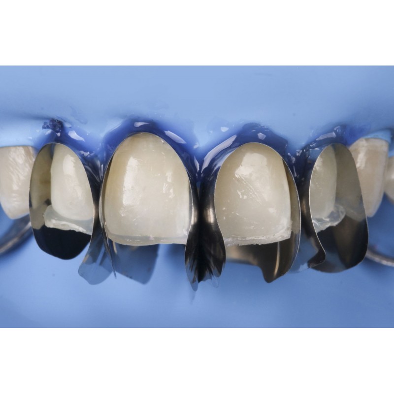 Unica Anterior Minideep 12szt. молдинги для передних зубов 6911