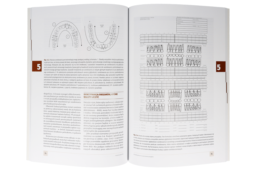 Книга: Ультразвуковая чистка пародонта. Теория и практика