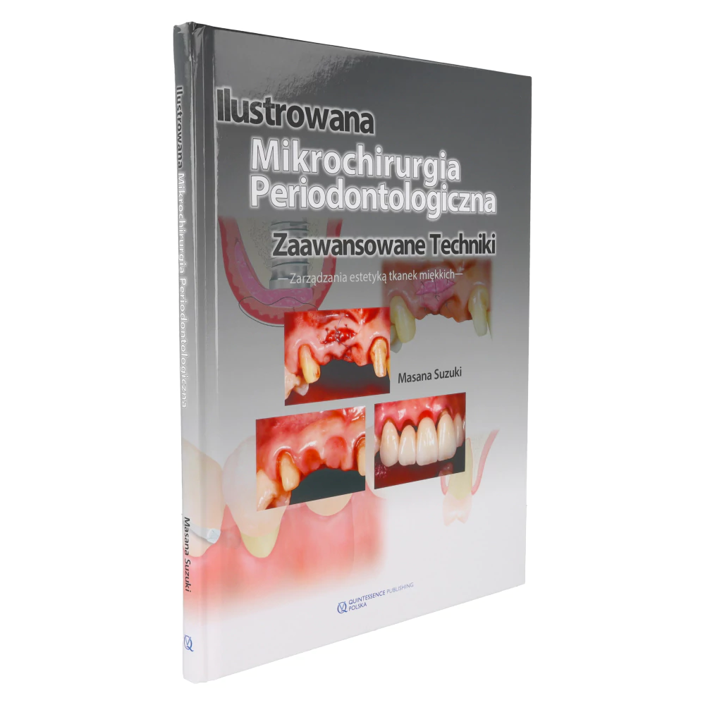 Книга: Иллюстрированная микрохирургия пародонтологии (М. Судзуки)