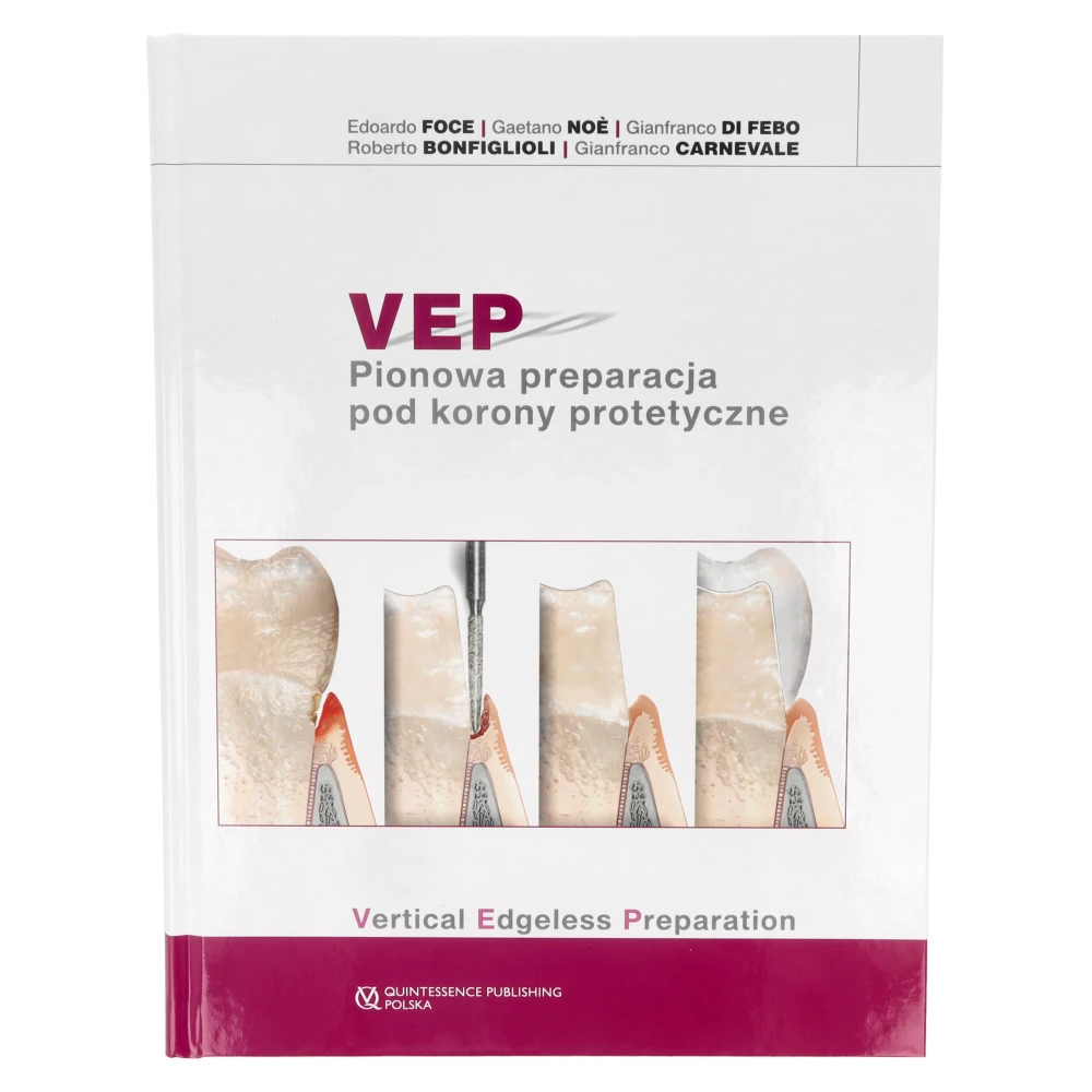 Книга: Вертикальная препарировка под протезные коронки