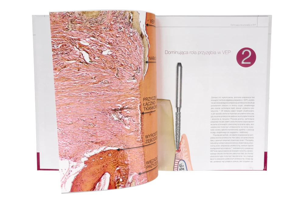 Книга: Вертикальная препарировка под протезные коронки